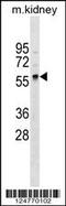 Polypeptide N-Acetylgalactosaminyltransferase 11 antibody, 59-594, ProSci, Western Blot image 