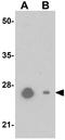NK2 Homeobox 6 antibody, GTX32059, GeneTex, Western Blot image 