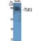 Tousled Like Kinase 1 antibody, LS-C386437, Lifespan Biosciences, Western Blot image 