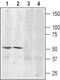 Adrenoceptor Beta 3 antibody, PA5-77284, Invitrogen Antibodies, Western Blot image 