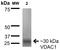 Voltage Dependent Anion Channel 1 antibody, orb150784, Biorbyt, Western Blot image 