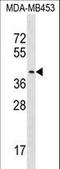 Pregnancy Specific Beta-1-Glycoprotein 9 antibody, LS-C158747, Lifespan Biosciences, Western Blot image 