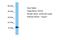 SEC61 Translocon Beta Subunit antibody, A30276, Boster Biological Technology, Western Blot image 