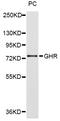 Growth Hormone Receptor antibody, STJ23783, St John