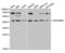 Serpin Family B Member 3 antibody, abx004151, Abbexa, Western Blot image 