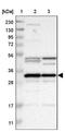 Methyltransferase Like 1 antibody, NBP1-88386, Novus Biologicals, Western Blot image 
