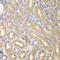 Interleukin 12 Receptor Subunit Beta 1 antibody, 14-916, ProSci, Immunohistochemistry paraffin image 