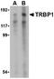TAR (HIV-1) RNA Binding Protein 1 antibody, LS-B596, Lifespan Biosciences, Western Blot image 