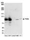 TOX high mobility group box family member 4 antibody, A304-873A, Bethyl Labs, Western Blot image 