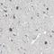 Solute Carrier Family 16 Member 7 antibody, HPA005911, Atlas Antibodies, Immunohistochemistry paraffin image 