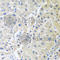 LDL Receptor Related Protein 6 antibody, A6134, ABclonal Technology, Immunohistochemistry paraffin image 
