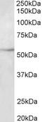 Tubulin Beta 3 Class III antibody, EB11685, Everest Biotech, Western Blot image 