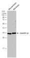 Protein Phosphatase 1 Regulatory Inhibitor Subunit 1B antibody, GTX133336, GeneTex, Western Blot image 