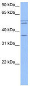 Coiled-Coil Domain Containing 78 antibody, TA337790, Origene, Western Blot image 