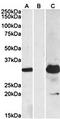 Potassium Channel Tetramerization Domain Containing 11 antibody, orb22520, Biorbyt, Western Blot image 