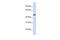 Glycosyltransferase 8 Domain Containing 1 antibody, GTX46675, GeneTex, Western Blot image 