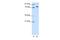 TOX High Mobility Group Box Family Member 4 antibody, A08509, Boster Biological Technology, Western Blot image 