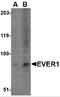 Transmembrane Channel Like 6 antibody, 4547, ProSci, Western Blot image 