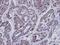 Inositol Polyphosphate-1-Phosphatase antibody, PA5-21691, Invitrogen Antibodies, Immunohistochemistry paraffin image 