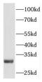 Pleckstrin Homology And FYVE Domain Containing 1 antibody, FNab06540, FineTest, Western Blot image 