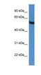 TBC1 Domain Family Member 10A antibody, NBP1-79843, Novus Biologicals, Western Blot image 