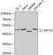 Keratin 15 antibody, GTX33139, GeneTex, Western Blot image 