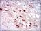 Cytochrome P450 Family 3 Subfamily A Member 4 antibody, NBP2-37502, Novus Biologicals, Immunohistochemistry paraffin image 