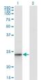 Ubiquitin Conjugating Enzyme E2 T antibody, H00029089-M03, Novus Biologicals, Western Blot image 