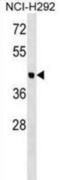 Otolin 1 antibody, abx028593, Abbexa, Western Blot image 