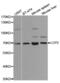 Lymphocyte Cytosolic Protein 2 antibody, abx002004, Abbexa, Western Blot image 