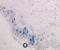 CD207 Molecule antibody, DDX0363P-100, Novus Biologicals, Immunohistochemistry frozen image 