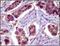 BCL10 Immune Signaling Adaptor antibody, 32-115, ProSci, Immunohistochemistry paraffin image 