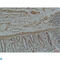 Galectin 3 antibody, LS-C812352, Lifespan Biosciences, Immunohistochemistry paraffin image 