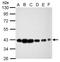 Cytokine Induced Apoptosis Inhibitor 1 antibody, NBP2-15901, Novus Biologicals, Western Blot image 