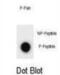 Unc-51 Like Autophagy Activating Kinase 2 antibody, abx032215, Abbexa, Western Blot image 