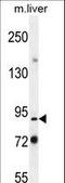 Poly(ADP-Ribose) Polymerase Family Member 9 antibody, LS-C164520, Lifespan Biosciences, Western Blot image 