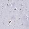 Echinoderm microtubule-associated protein-like 1 antibody, HPA049105, Atlas Antibodies, Immunohistochemistry paraffin image 