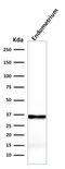 Calponin 1 antibody, GTX34449, GeneTex, Western Blot image 