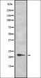 TPD52 Like 1 antibody, orb337629, Biorbyt, Western Blot image 