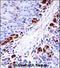 MAPK Activated Protein Kinase 5 antibody, LS-C164477, Lifespan Biosciences, Immunohistochemistry paraffin image 