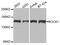 Rho Associated Coiled-Coil Containing Protein Kinase 1 antibody, A1008, ABclonal Technology, Western Blot image 