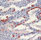 Surfactant Protein B antibody, LS-C88384, Lifespan Biosciences, Immunohistochemistry frozen image 