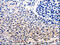Cell Division Cycle 20 antibody, CSB-PA153558, Cusabio, Immunohistochemistry paraffin image 