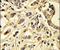 Fms Related Tyrosine Kinase 1 antibody, PA5-26320, Invitrogen Antibodies, Immunohistochemistry paraffin image 