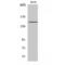 Erb-B2 Receptor Tyrosine Kinase 3 antibody, LS-C383406, Lifespan Biosciences, Western Blot image 