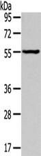 Thyroid Hormone Receptor Alpha antibody, TA350496, Origene, Western Blot image 