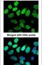 Valosin Containing Protein antibody, PA5-22257, Invitrogen Antibodies, Immunofluorescence image 