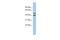 Apolipoprotein B MRNA Editing Enzyme Catalytic Polypeptide Like 4 antibody, TA333315, Origene, Western Blot image 