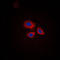 Ring Finger Protein 144A antibody, LS-C353197, Lifespan Biosciences, Immunofluorescence image 