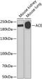 Angiotensin I Converting Enzyme antibody, 23-091, ProSci, Western Blot image 